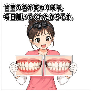 歯茎の色が変わります。毎日磨いてくれたからです。